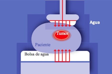 Oncothermia